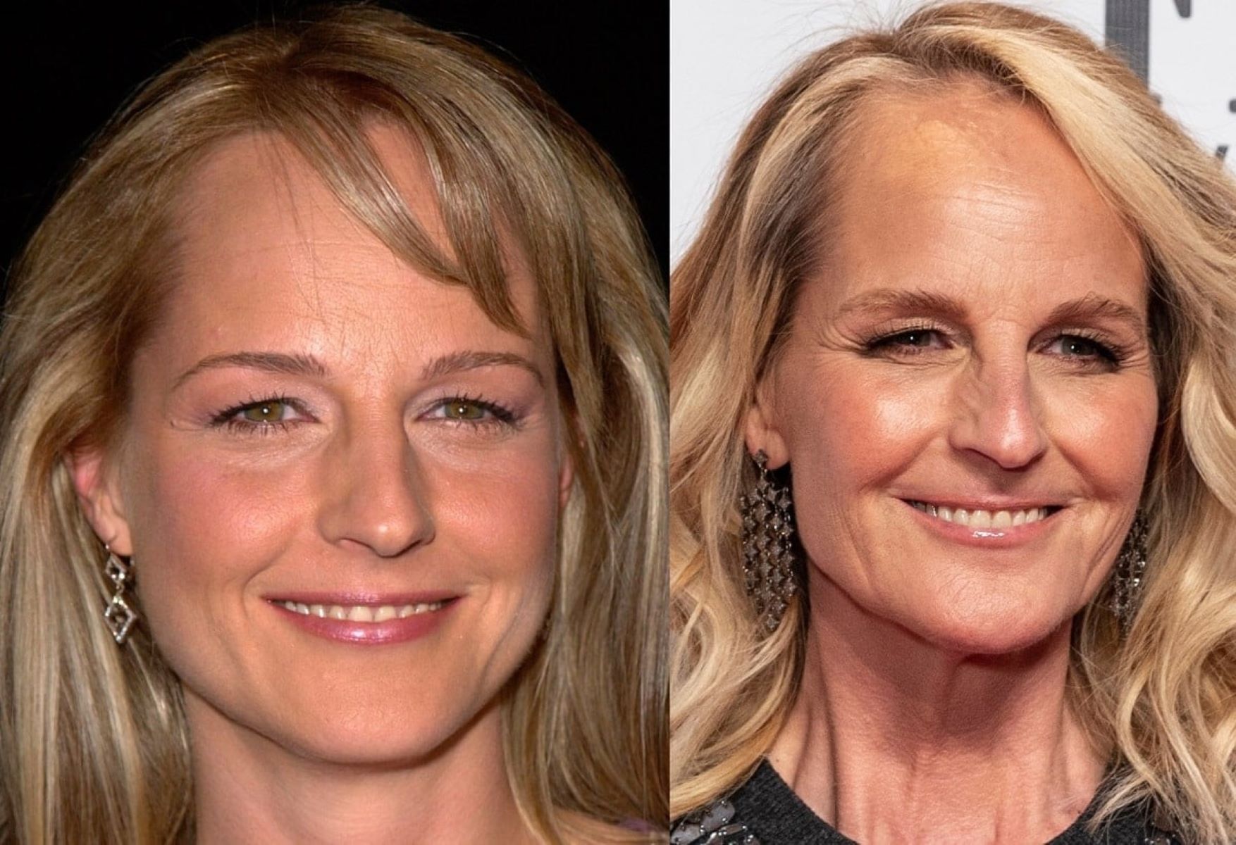 Helen Hunt's Shocking Transformation: What Really Happened To Her Looks?