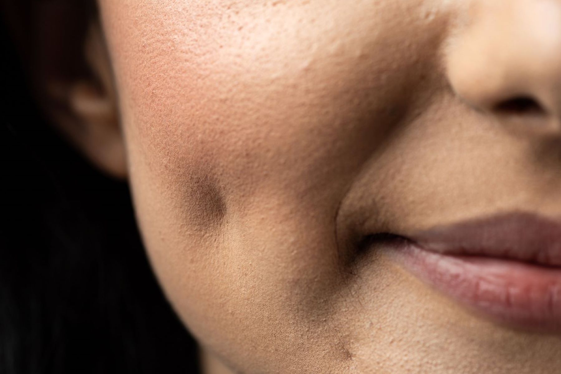 Say Goodbye To Your Dimples: Discover The Different Types And Effective Ways To Reduce Them