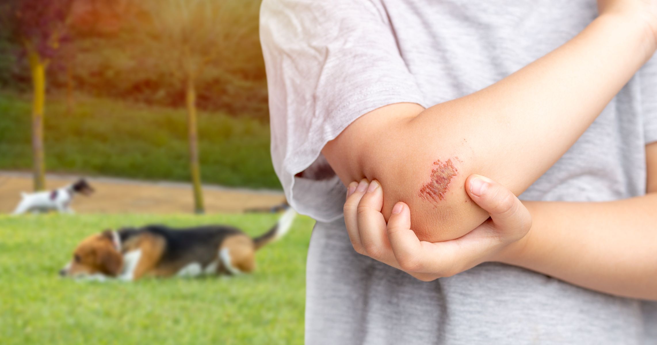 The Shocking Truth About Dog Scratches - You Won't Believe How Dangerous They Can Be!