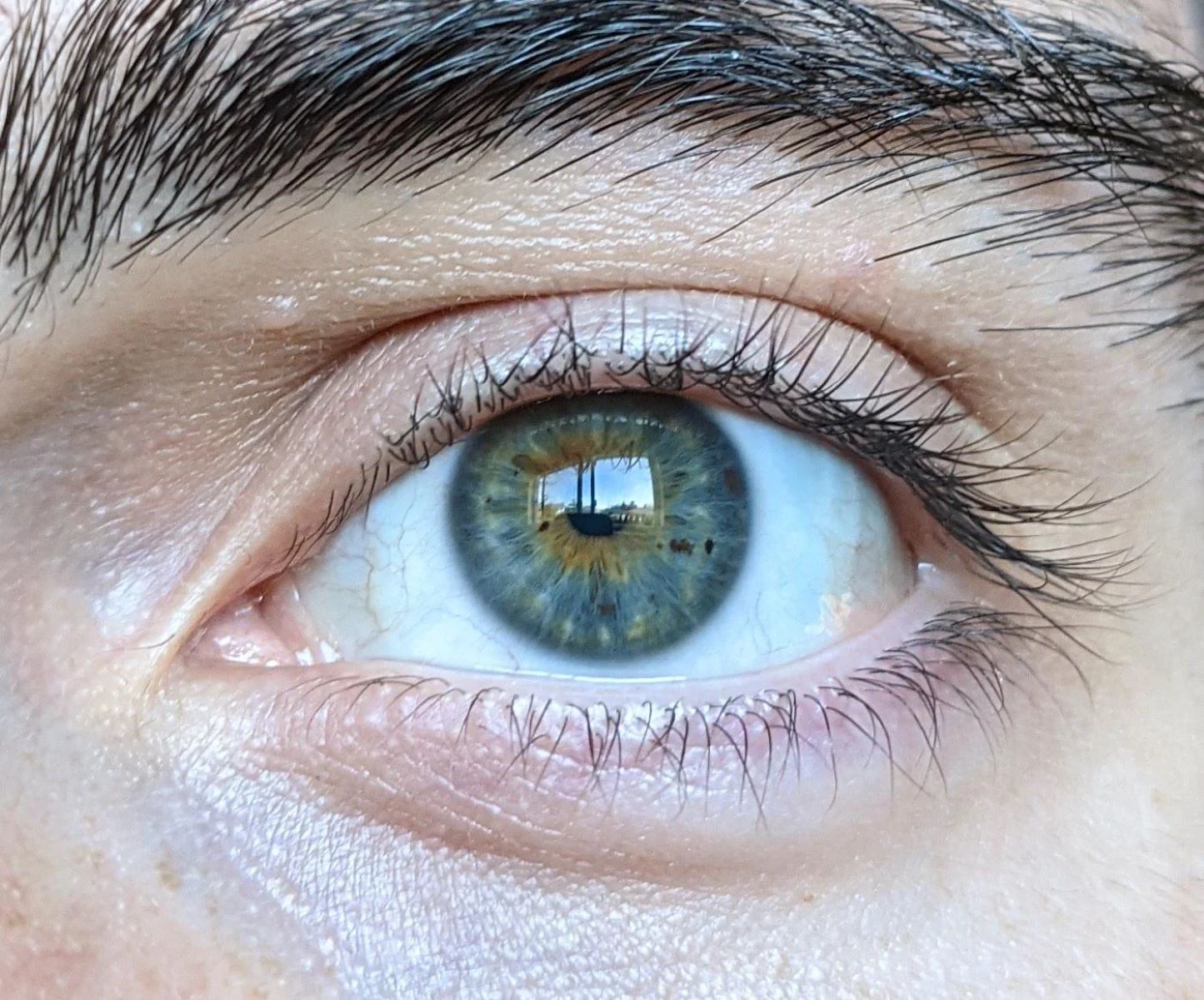 The Ultimate Guide To Distinguishing Hazel Eyes From Central Heterochromia