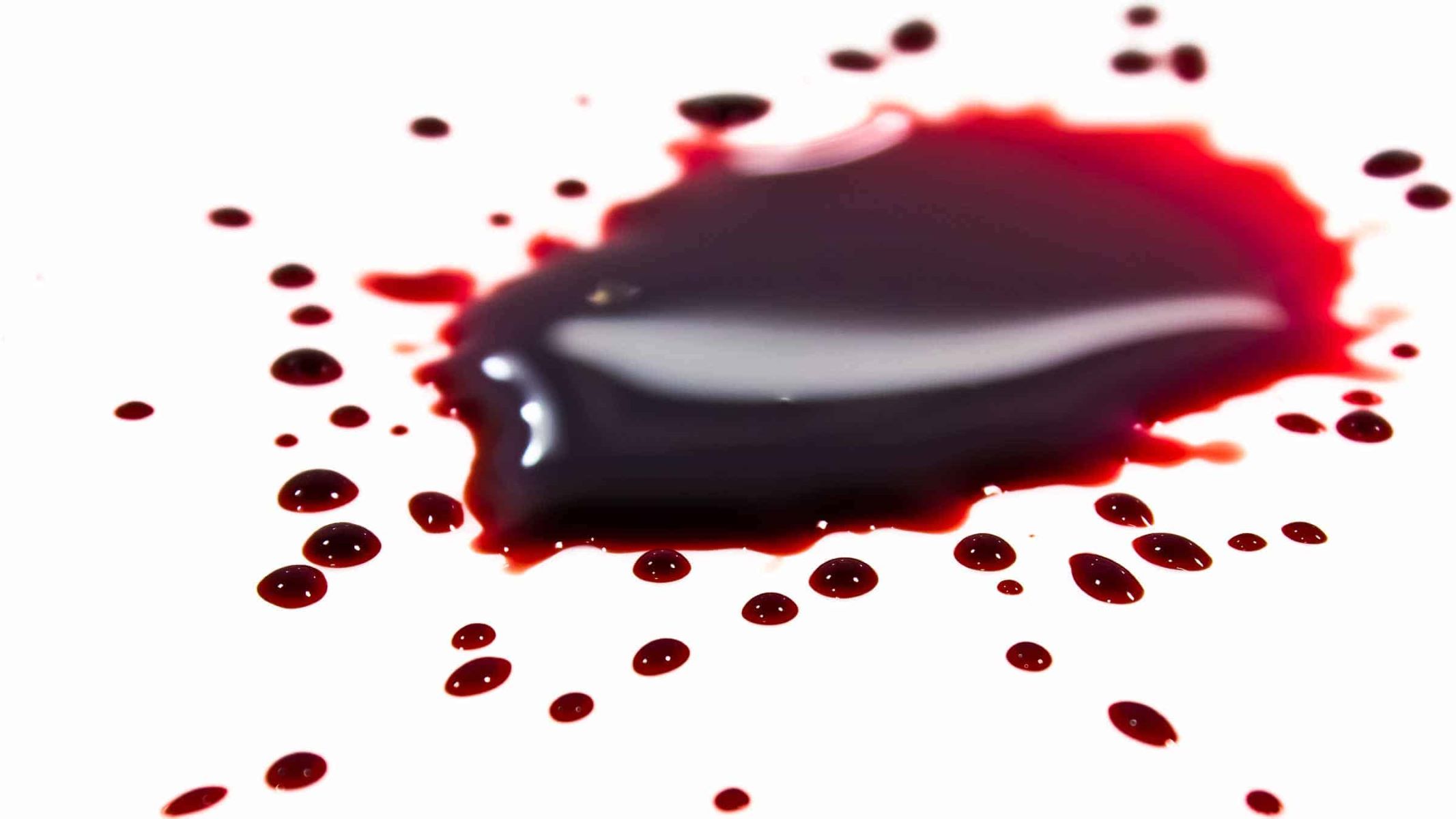 Unveiling The Mysterious Scent Of Blood: Prepare To Be Surprised!