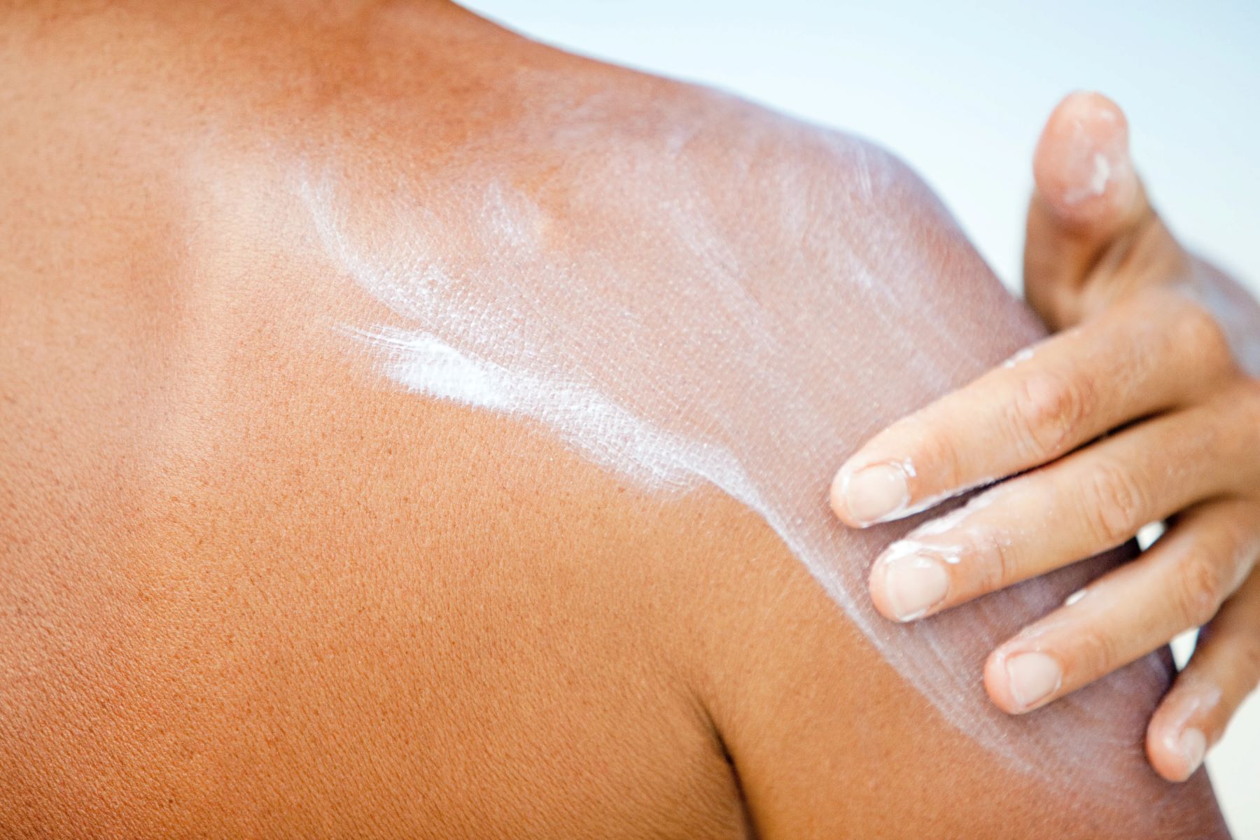 Covering Up Your Sunburn? Here's Why You Can Still Go Sun Tanning!