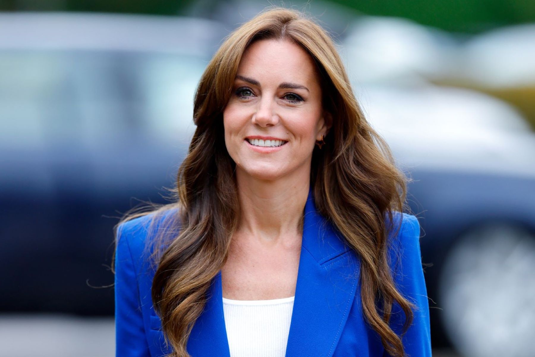 Kate Middleton's Recent Cosmetic Procedures Revealed - Unveiling The Truth!