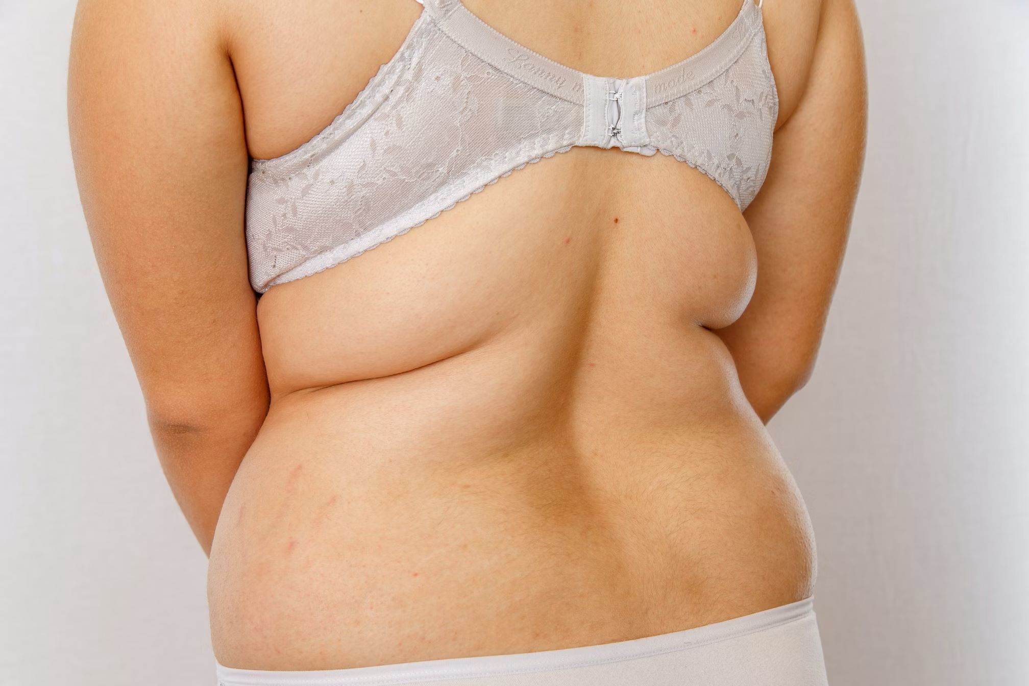 Say Goodbye To Those Pesky Fat Rolls Under Your Breasts With These Genius Tricks!