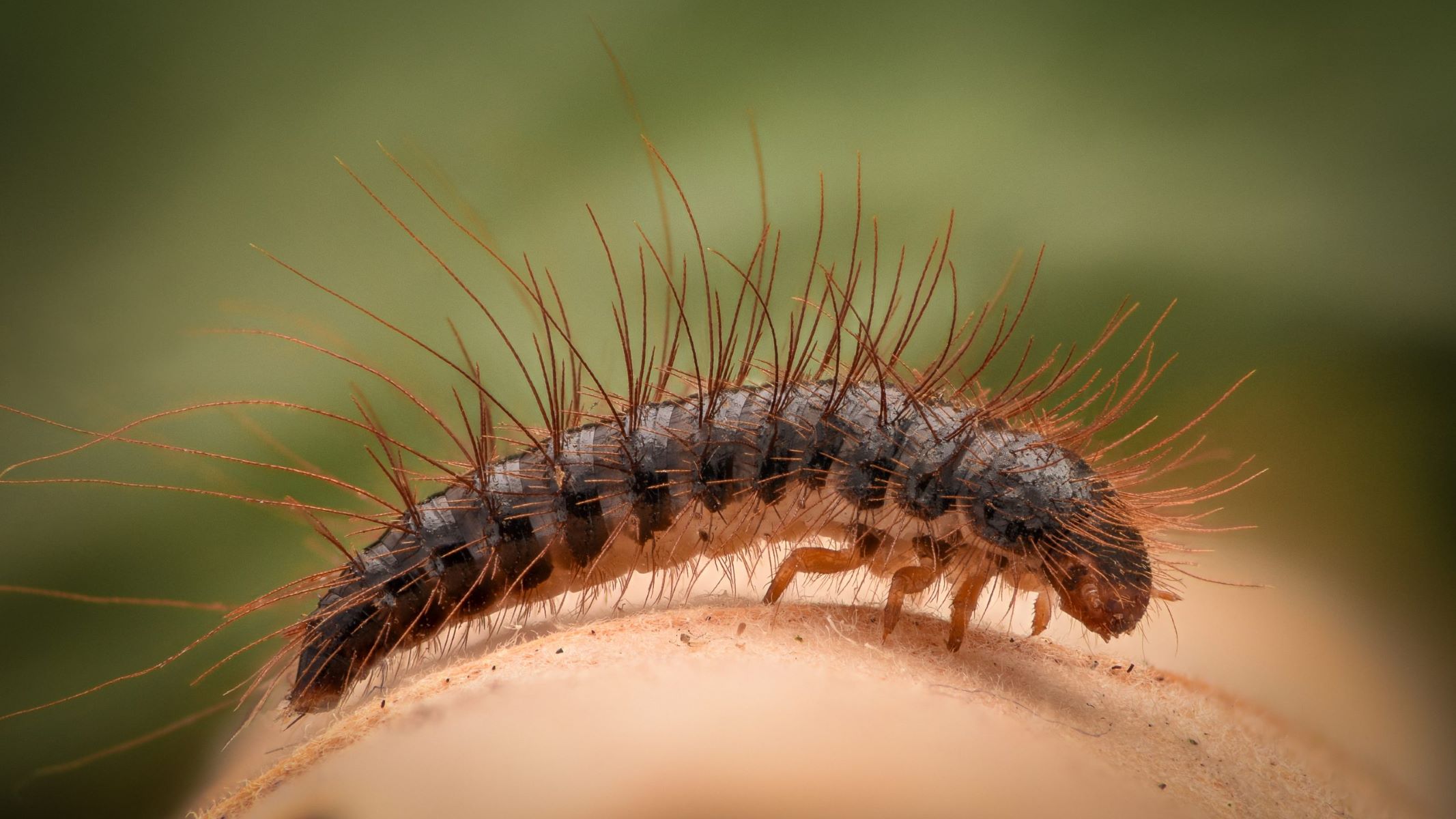 Shocking Truth: Carpet Beetle Larvae Hairs Lurking In Your Clean Clothes Can Cause Rash!